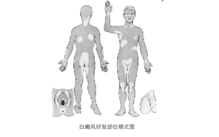 王宏偉教授專欄|白癜風相關知識科普(圖1)
